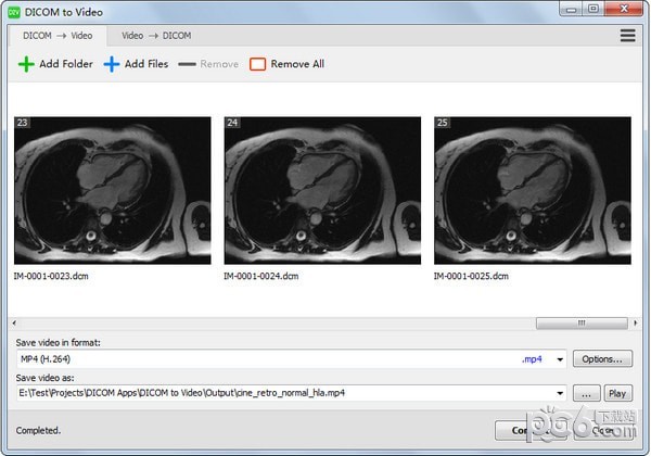 DICOM to Video(DICOM转视频工具)